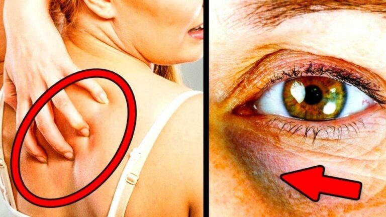 Diese überraschenden Anzeichen zeigen dir, dass du zu viel Zucker konsumierst…