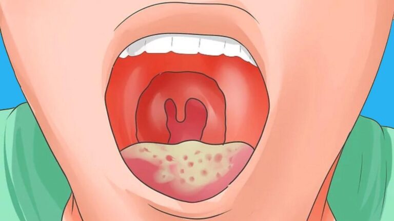 Diese einfachen Anzeichen helfen dir, eine HIV-Erkrankung frühzeitig zu erkennen…