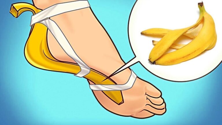 Diese einfache Methode verwandelt Bananenschalen in ein großartiges Gartenwundermittel…